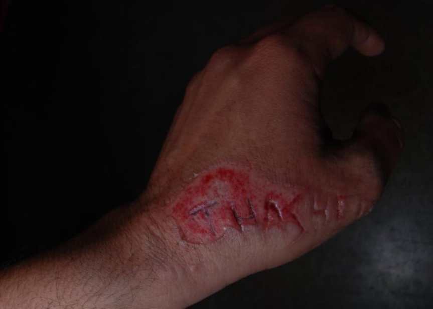 thrasher magazine scar tattoo